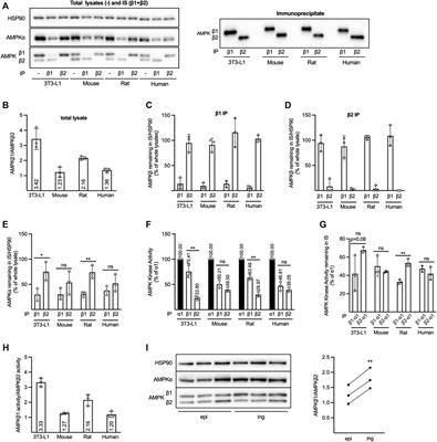 AMPKβ isoform expression patterns in various adipocyte models and in relation to body mass index